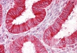 SCNN1D Antibody, Novus Biologicals 0.1mg; Unlabeled:Antibodies, Polyclonal